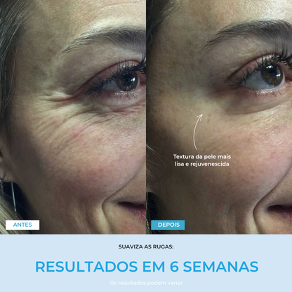 Liftlab — Modelador Facial Rejuvenescedor com Sérum Grátis