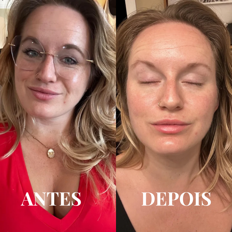 Máscara de Colágeno Glow Up 2.0