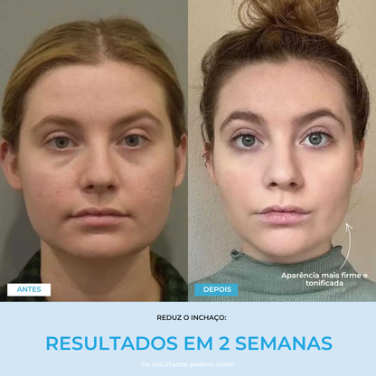 Liftlab — Modelador Facial Rejuvenescedor com Sérum Grátis