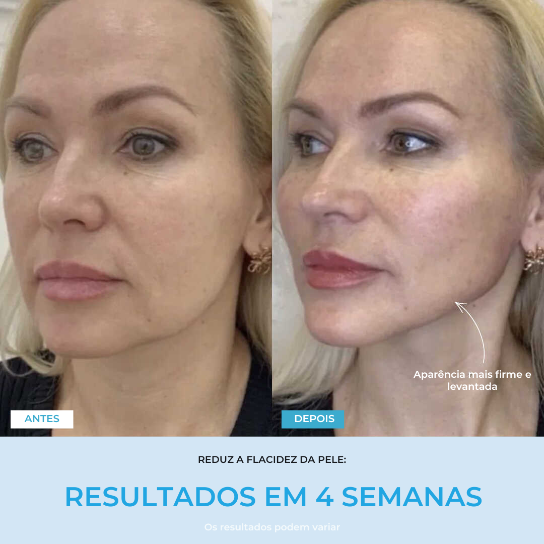 Liftlab — Modelador Facial Rejuvenescedor com Sérum Grátis